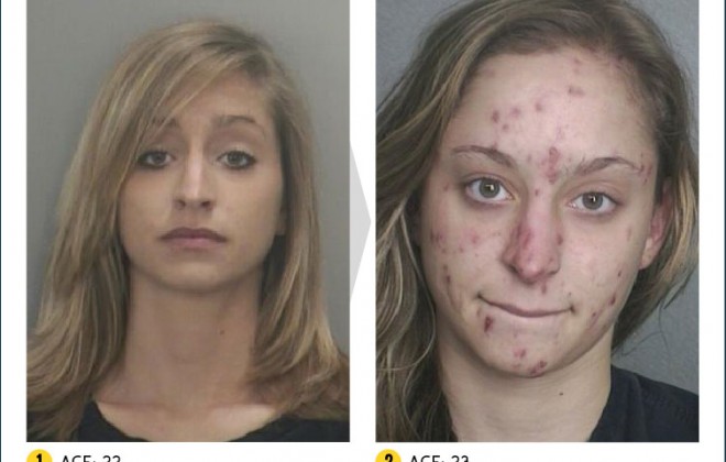 Meth - NOT EVEN ONCE