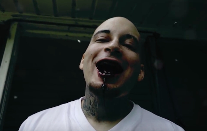 Man Who Shot Himself In The Face Releases Rap Music Video