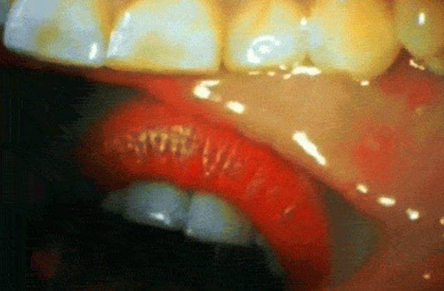A Kiss Filmed From Inside Someone's Mouth