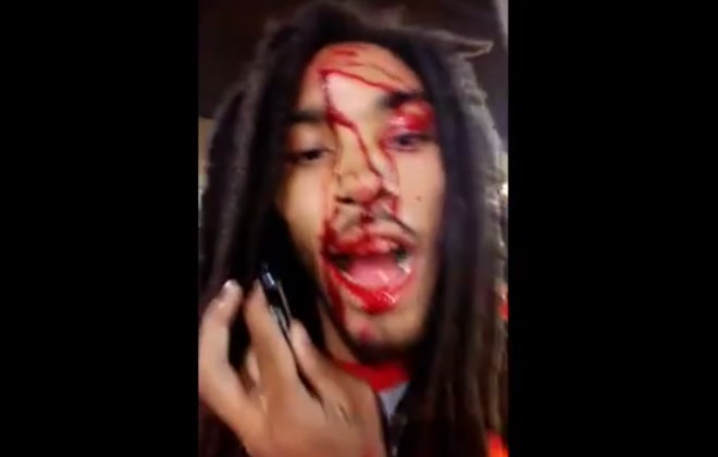 Rapper Gets Shot In Head, Immediately Films Video For Facebook